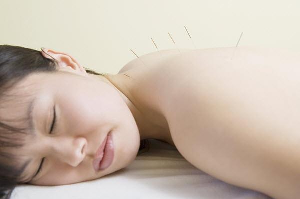 acupuncture for back pain