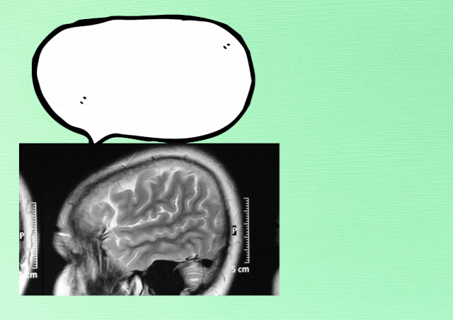  ProMind Complex Reviews: Does it Really Work?