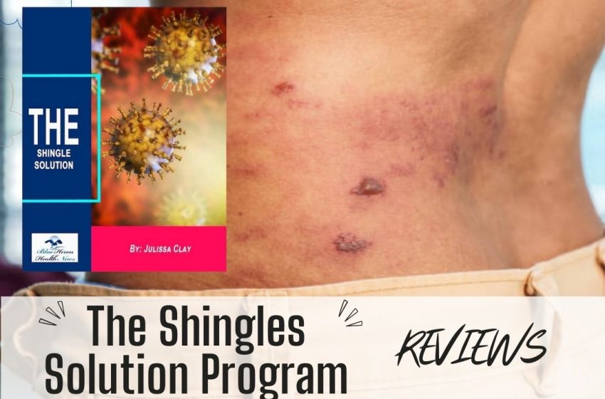  The Shingles Solution Reviews 2022: Does it Really Work?