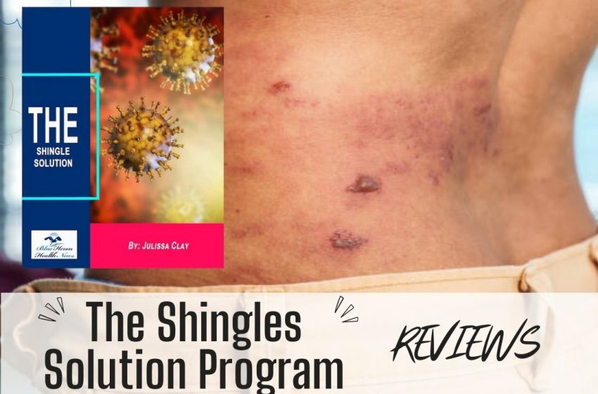  The Shingles Solution Reviews 2023: Does it Really Work?