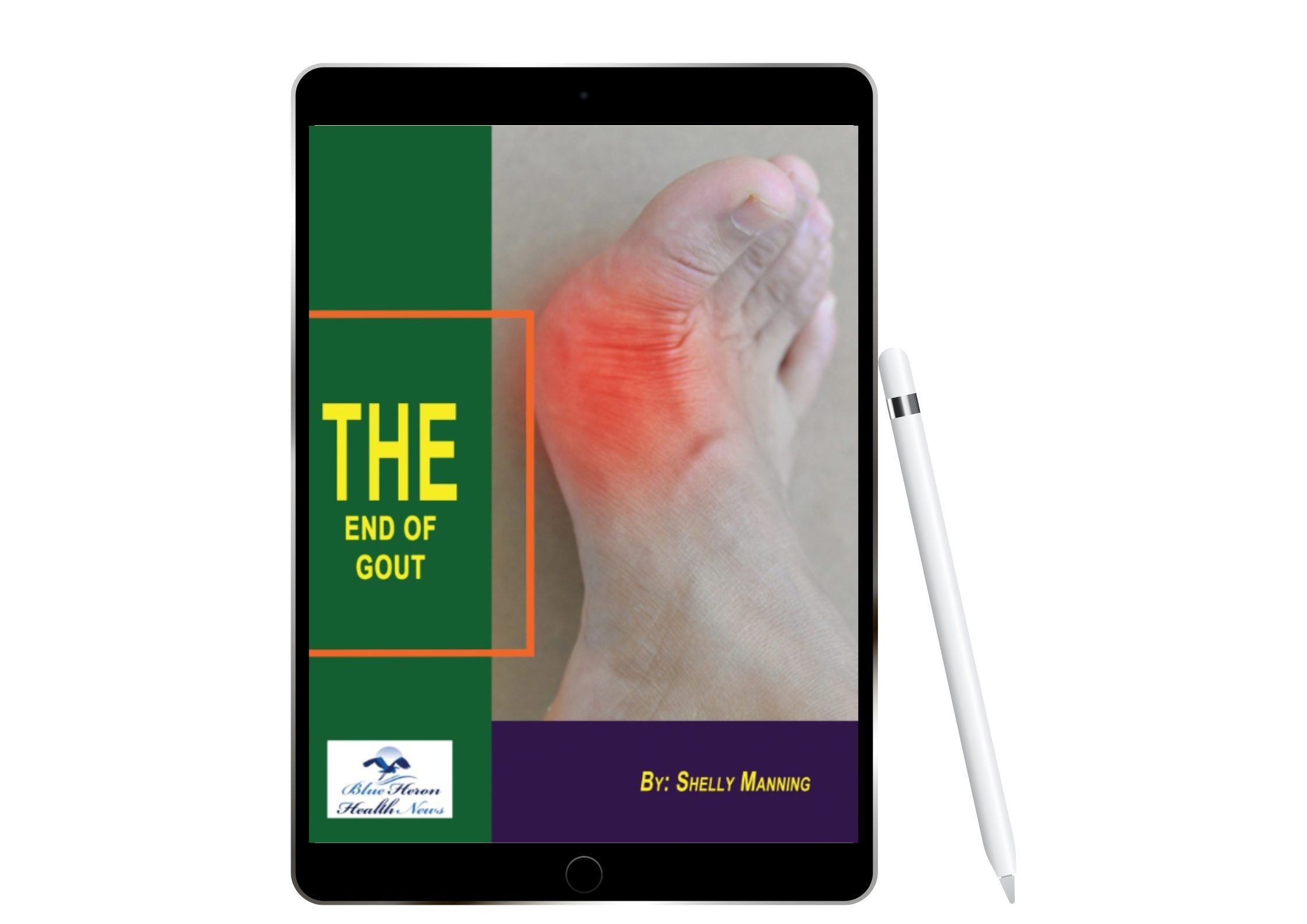 the end of gout reviews