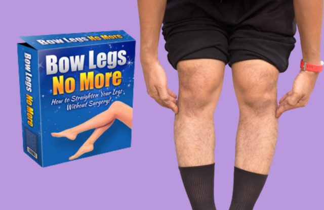 bow legs no more reviews