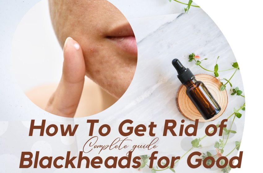  How to Get Rid of Blackheads for Good: Complete Guide 2023