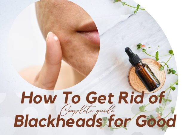 how to get rid of blackheads