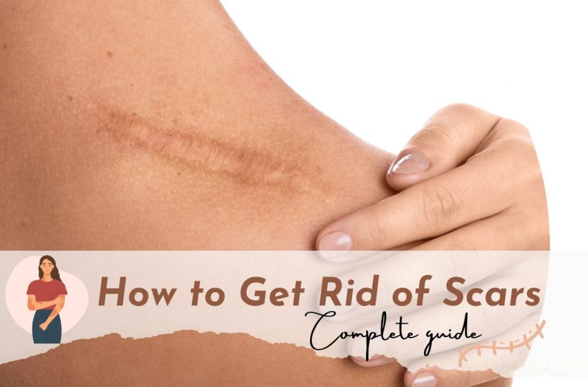  How to Get Rid of Scars: Complete Guide 2023