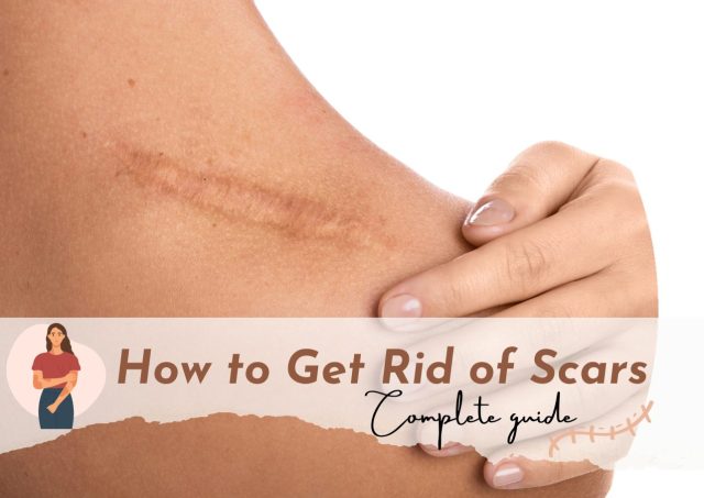 how to get rid of scars