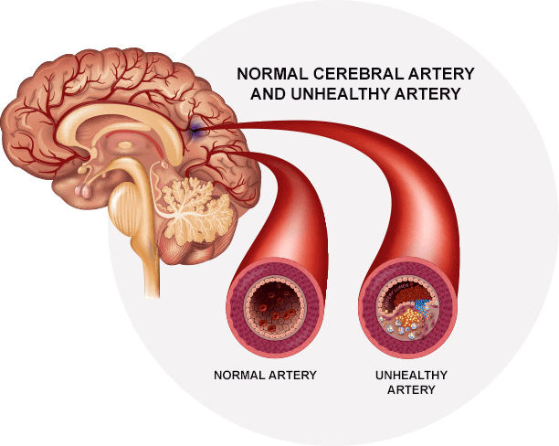 brain c-13 benefits