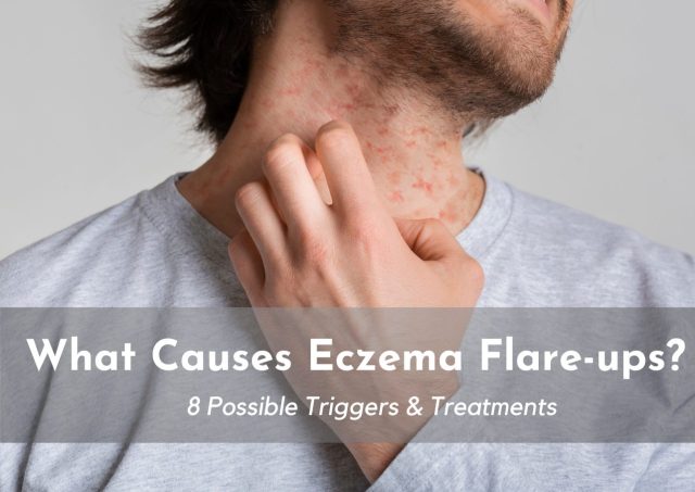 what causes eczema flare ups