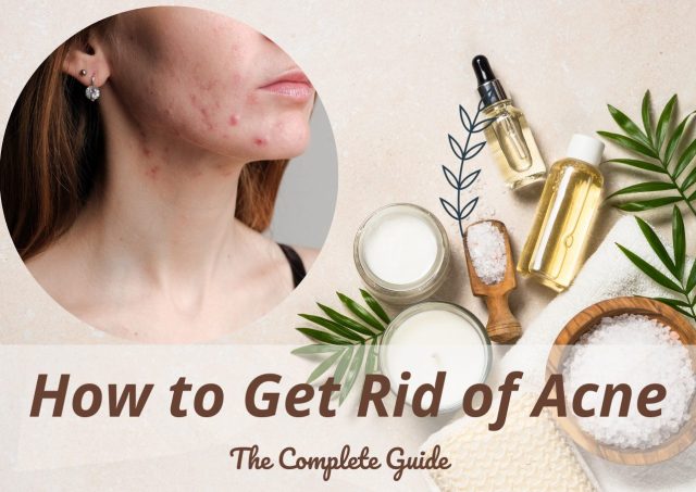 how to get rid of acne