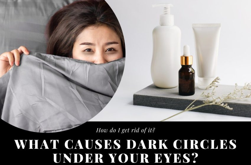  What Causes Dark Circles Under Your Eyes?
