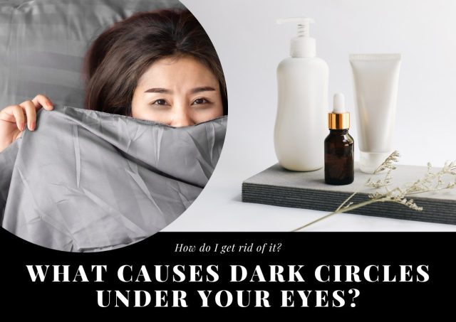 what causes dark circles under eyes