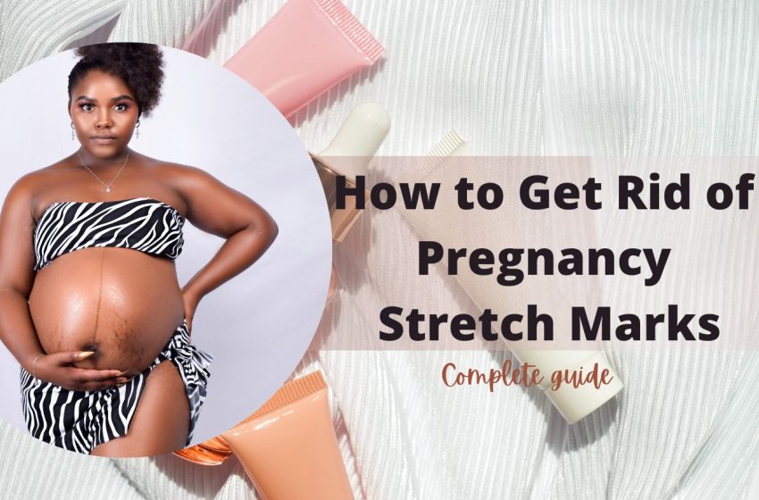  How to Get Rid of Pregnancy Stretch Marks: Complete Guide 2023