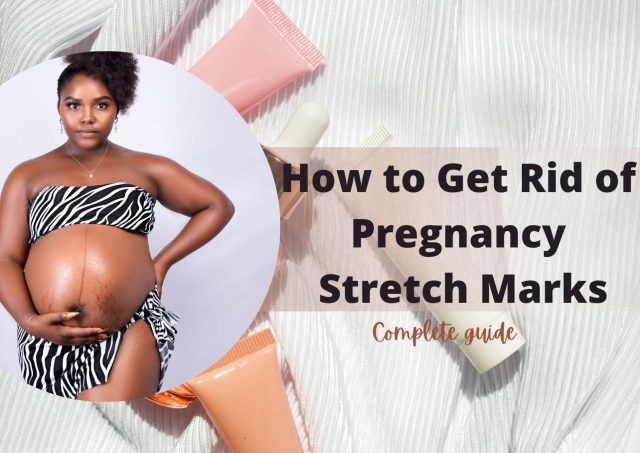 How to get rid of pregnancy stretch marks