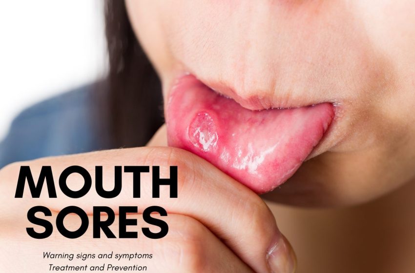  Mouth Sores – What is it and How to treat it?