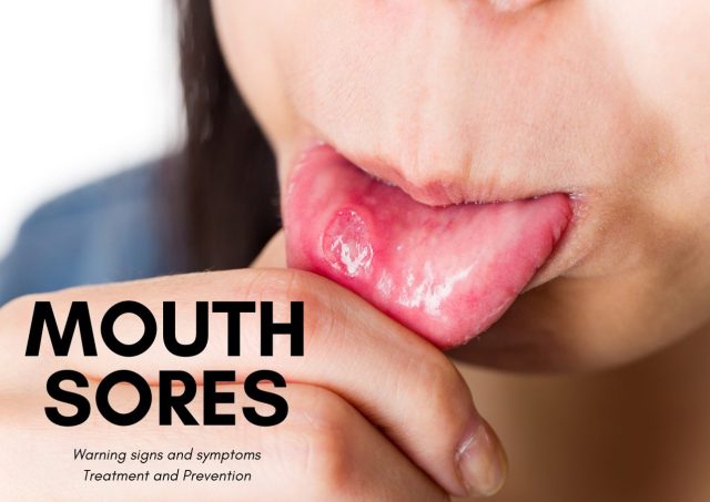 MOUTH SORES