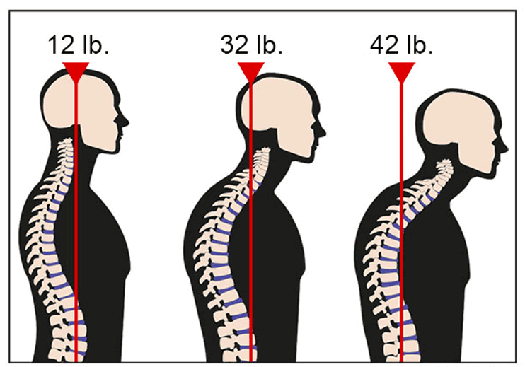 forward head posture benefits