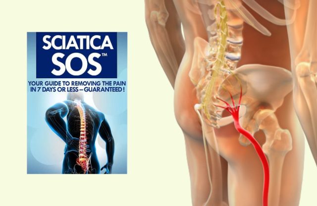 Sciatica SOS reviews