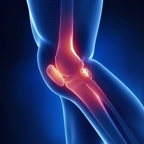 how to get rid of knee pain fast