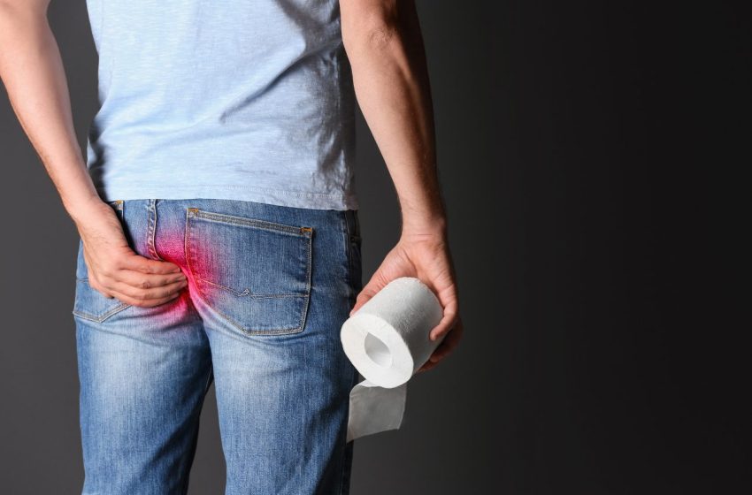  6 Treatments for Hemorrhoid Relief: Complete Guide 2023