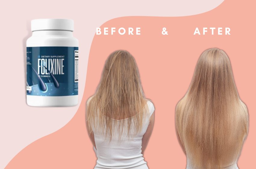  Folixine Reviews 2023: Does it Really Work For Hair Growth?