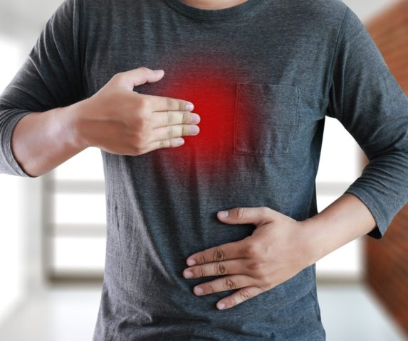 acid reflux treatment