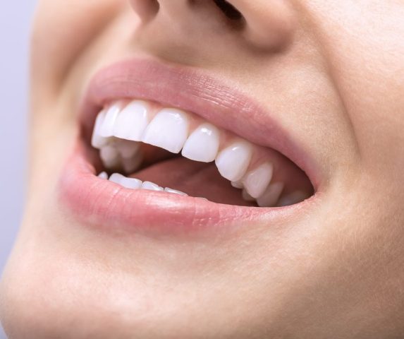 best teeth whitening