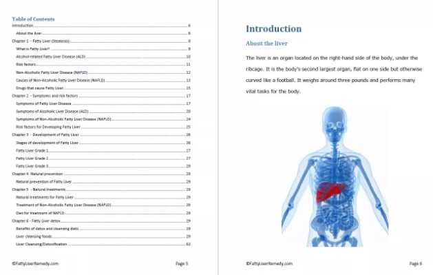 fatty liver remedy