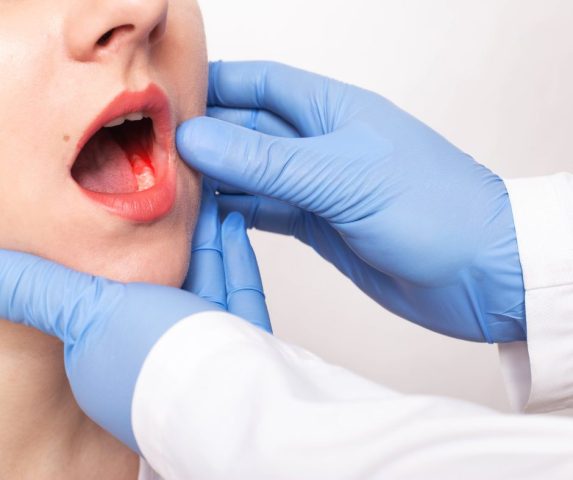 how to treat gum disease