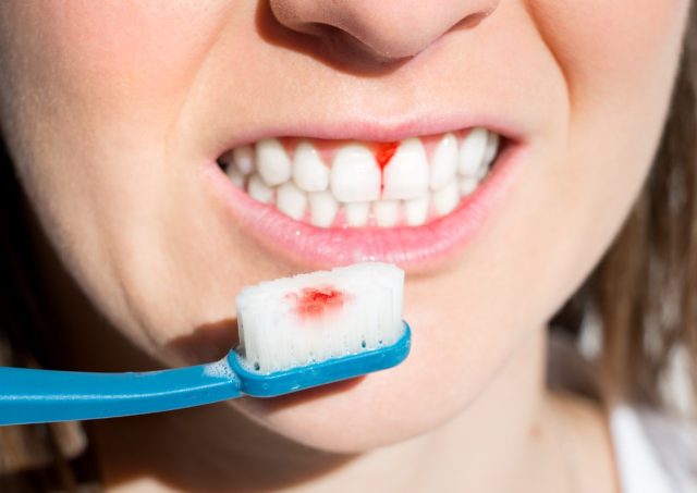 how to treat gum disease (2)