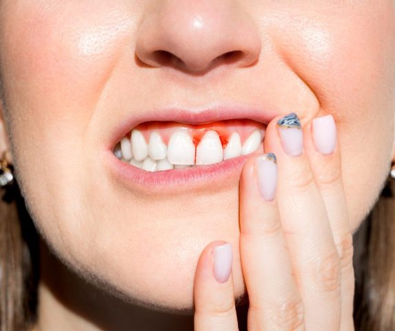 how to treat gum disease