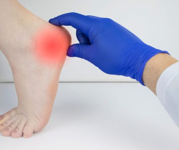 heel pain