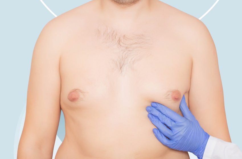 3 Ways On How To Get Rid of Man Boobs: Complete Guide 2023