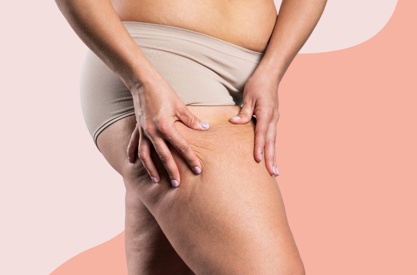 6 Tips On How to Lose Thigh Fat: Complete Guide 2023