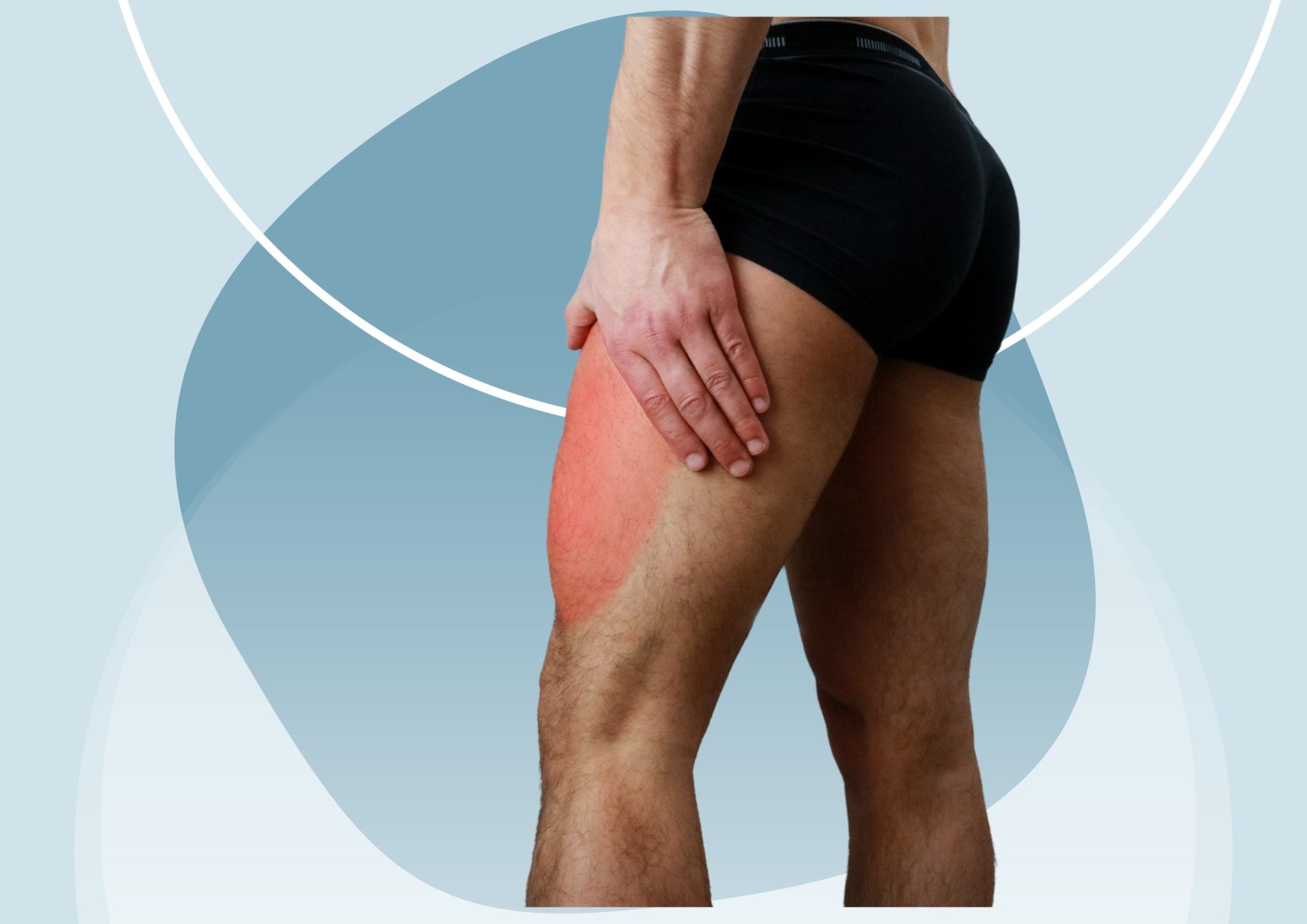 7 Common Causes Of Thigh Pain: Complete Guide • Dumb Little Man