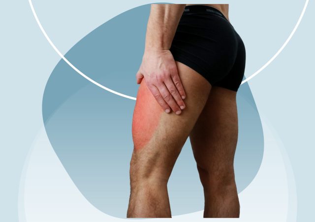 7 Common Causes Of Thigh Pain: Complete Guide 2023