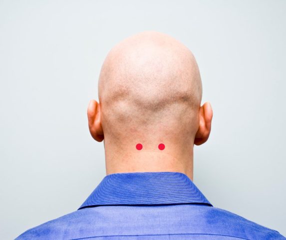 headache pressure points (1)