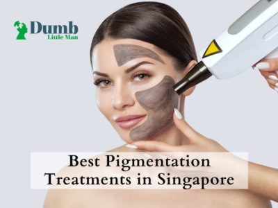 Best Pigmentation Treatments in Singapore