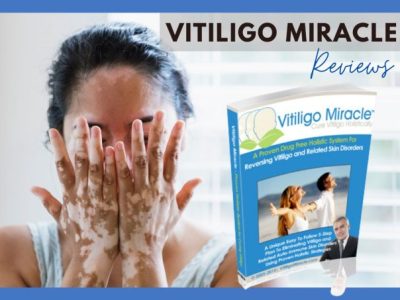 vitiligo miracle reviews